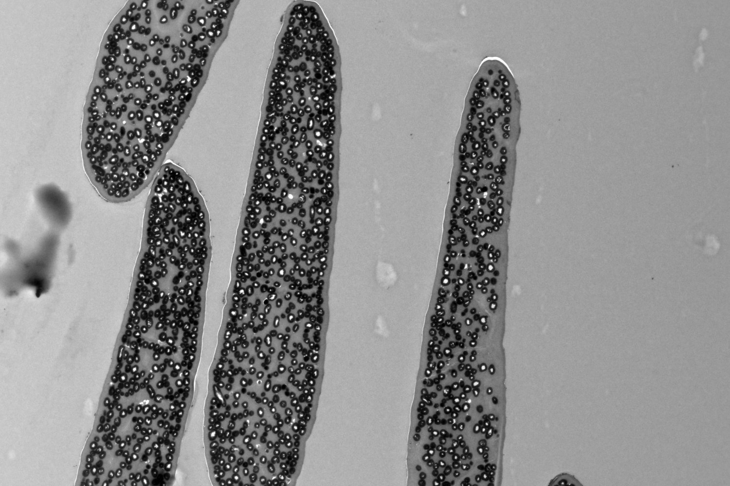Raw transmission electron micrograph