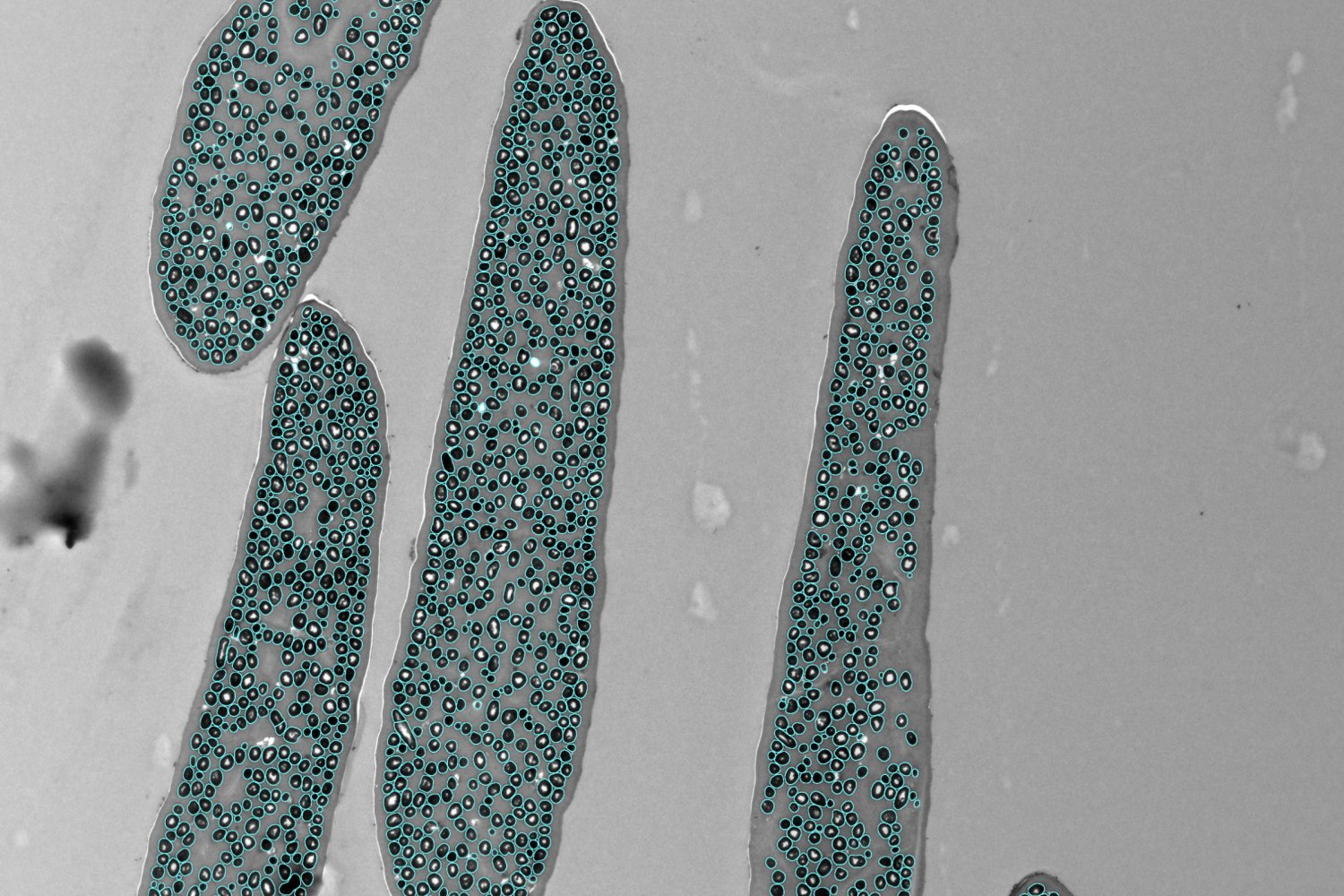 Micrograph with every structure delineated in teal by the platform